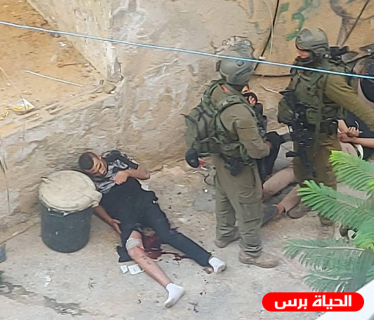 الاحتلال يصيب مواطن ويعتقل 3 آخرين في طولكرم